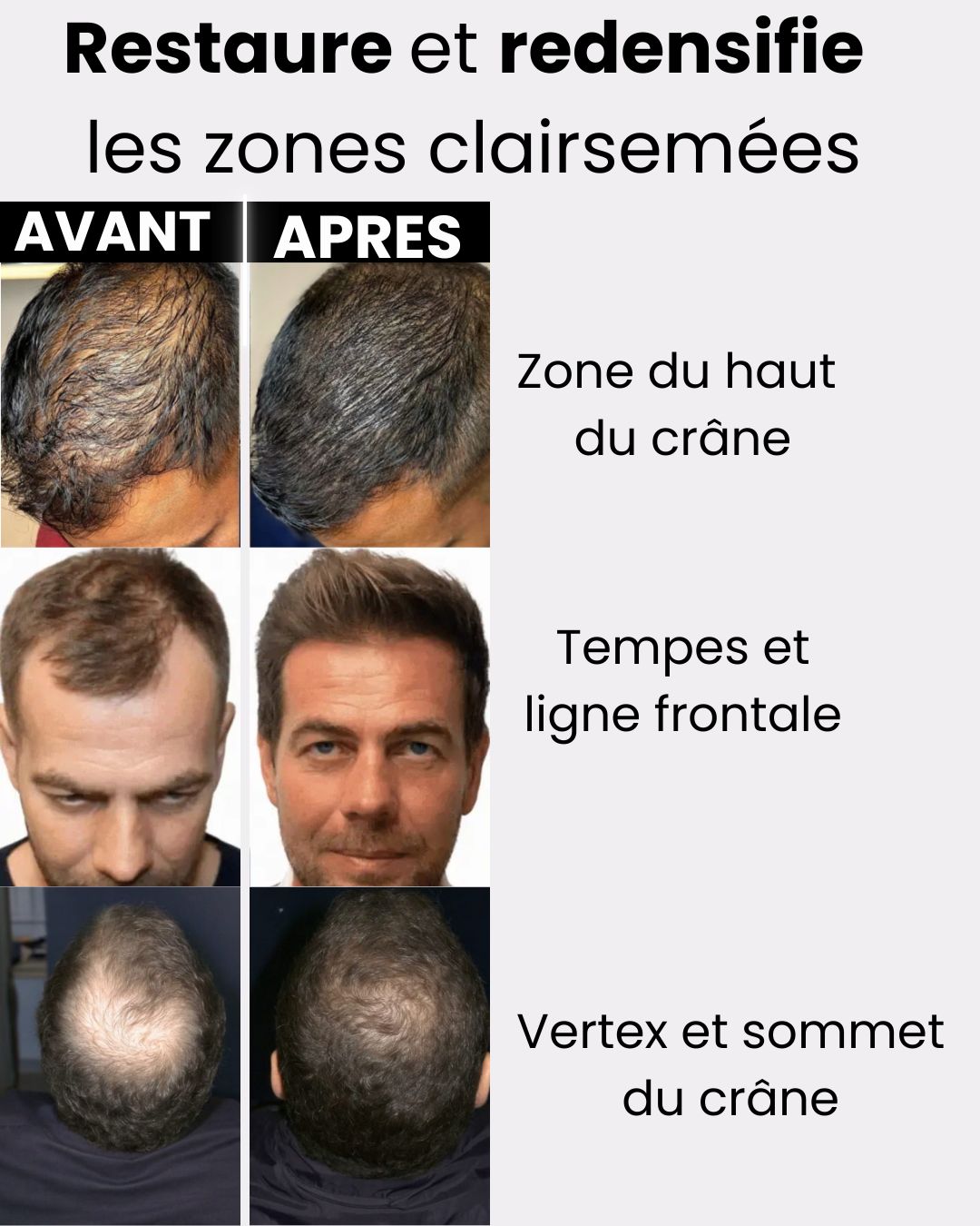 Solution Capillaire Antichute & Repousse