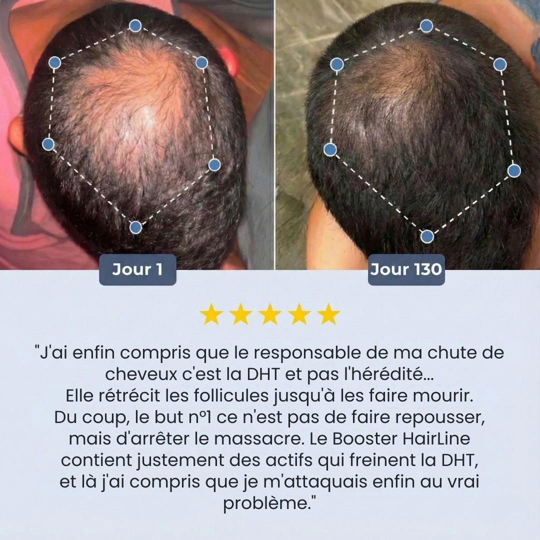Croissance Boosteur HairLine™
