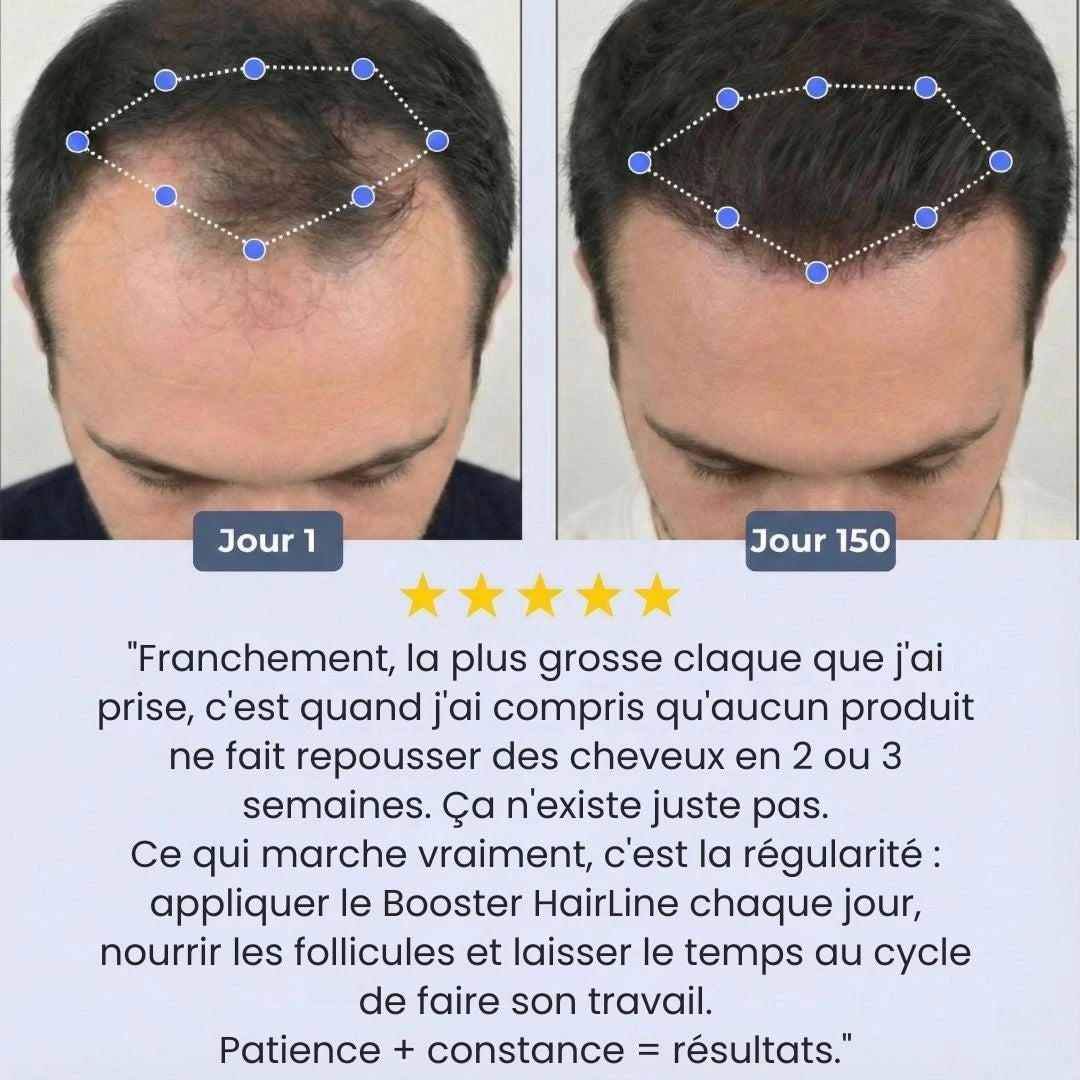 Croissance Boosteur HairLine™