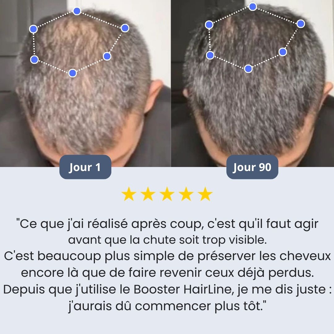 Sérum Roll-on Booster HairLine™