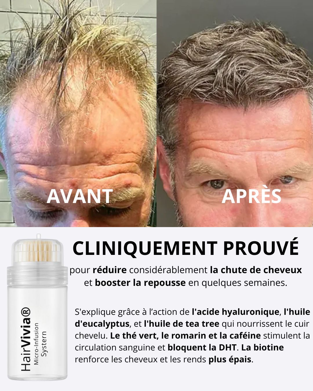 Solution Capillaire Antichute & Repousse