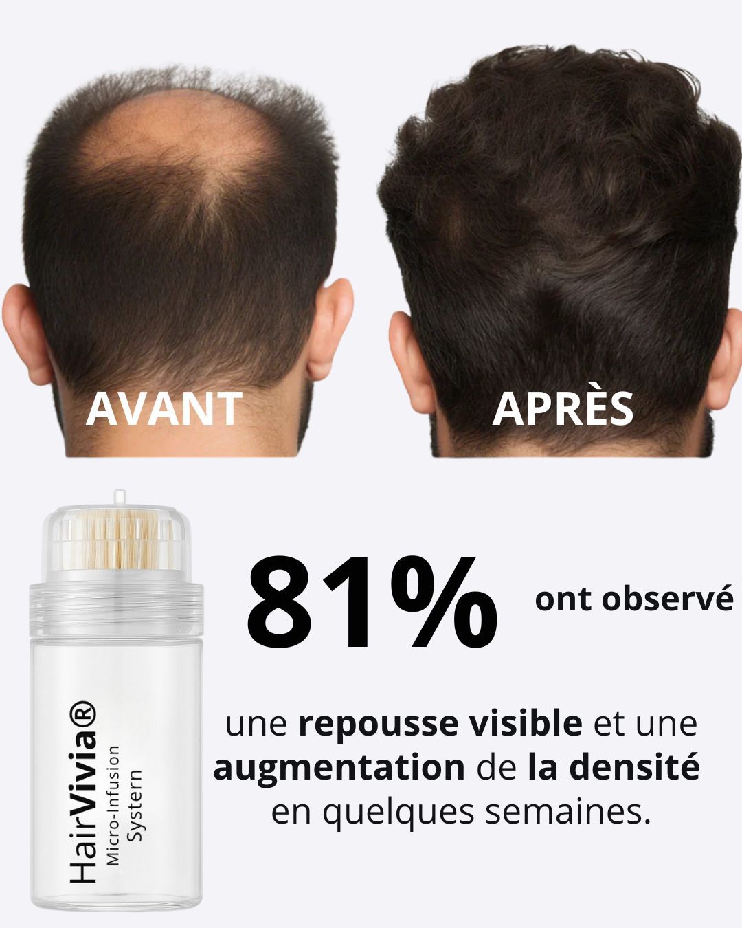 Solution Capillaire Antichute & Repousse