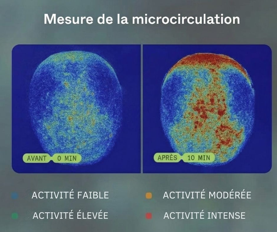 Mesure de la microcirculation
