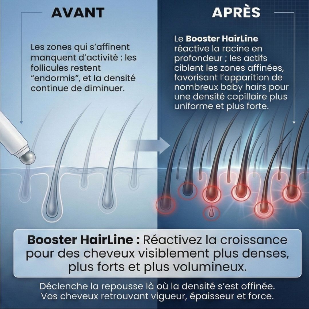 Sérum Roll-on Booster HairLine™