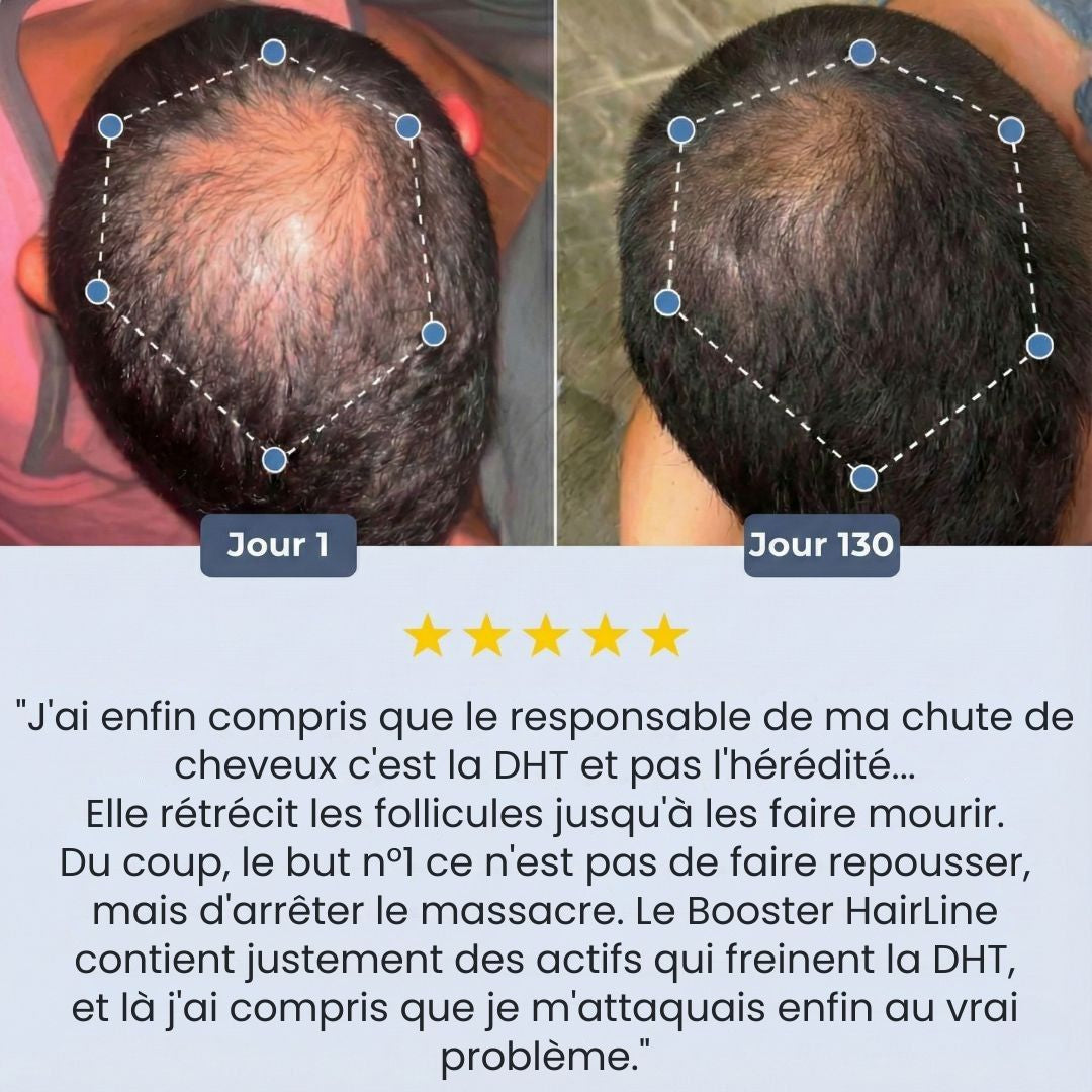 Sérum Roll-on Booster HairLine™