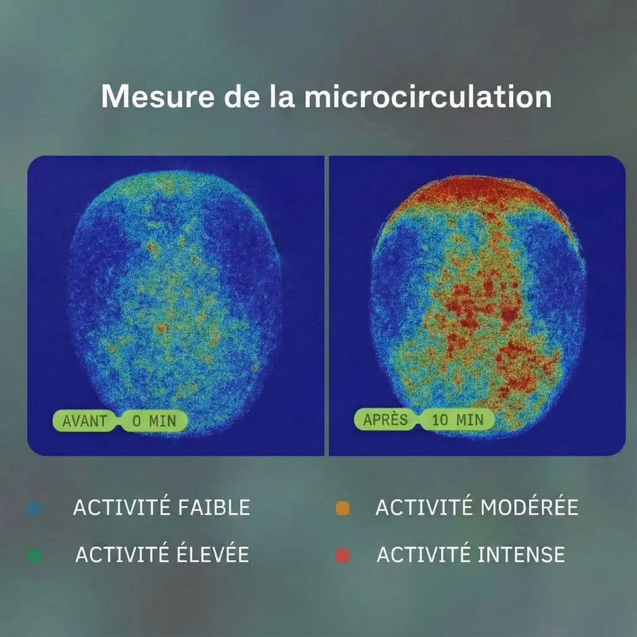 Mesure de la microcirculation