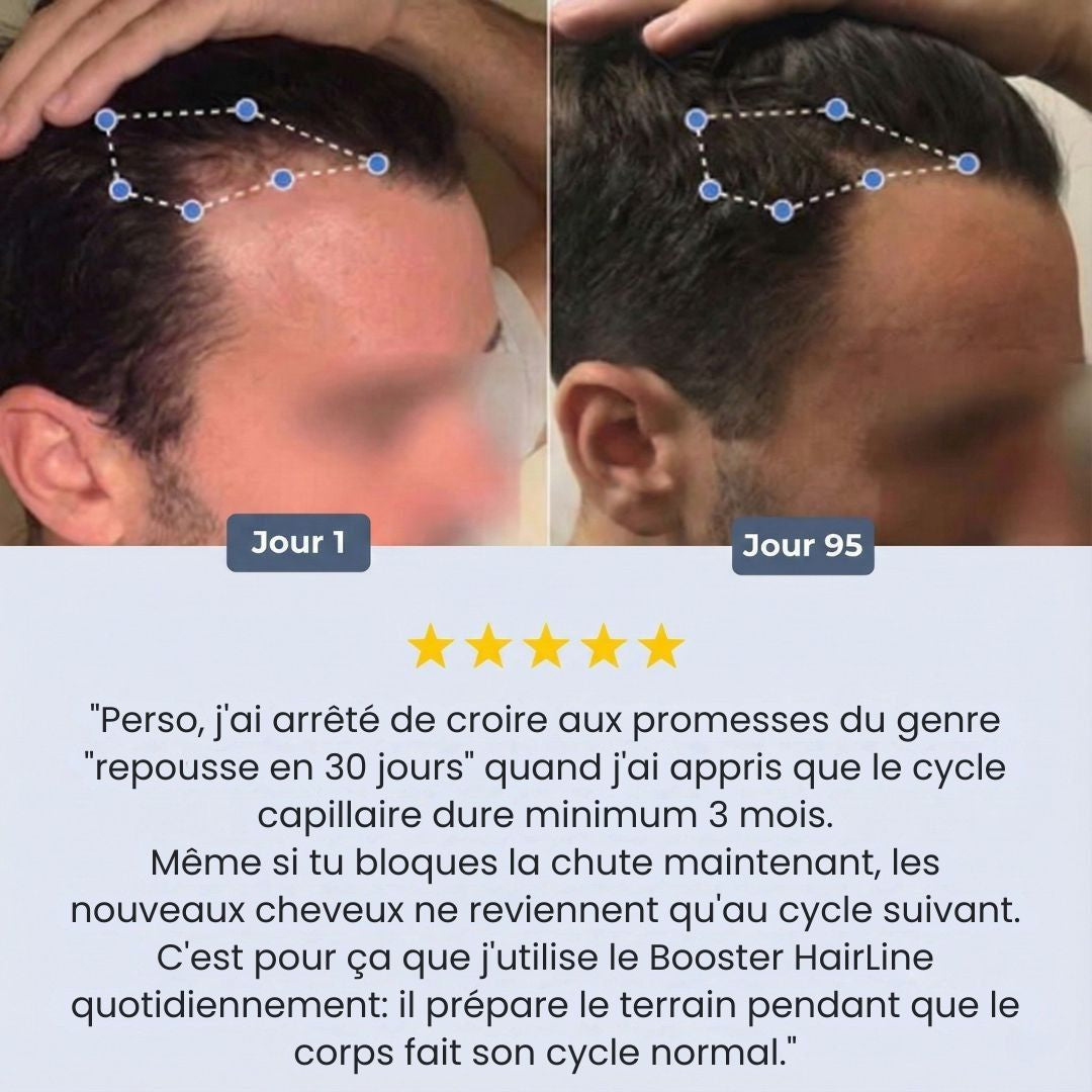 Sérum Roll-on Booster HairLine™